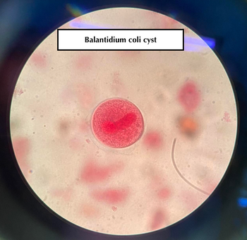 Balantidium coli cyst
A