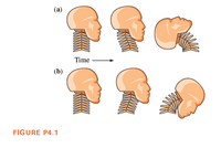 (a)
Time
(b)
FIGURE P4.1
