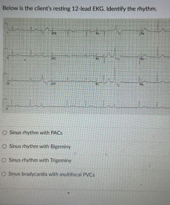 Below is the client's resting 12-lead EKG. Identify the rhythm.
من بلدية
HVR
VA
aVF
O Sinus rhythm with PACs
O Sinus rhythm with Bigeminy
O Sinus rhythm with Trigeminy
O Sinus bradycardia with multifocal PVCS
V3
N
A
Th
15
V6