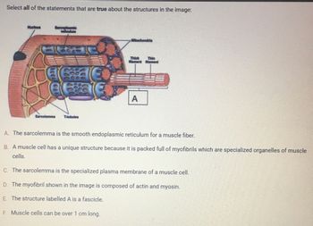 Select all of the statements that are true about the structures in the image:
Nucleus
Sarcoplasmic
135136
Sarcolemma T-tubules
€
Mitochondria
Thick
Blament
A
A. The sarcolemma is the smooth endoplasmic reticulum for a muscle fiber.
B. A muscle cell has a unique structure because it is packed full of myofibrils which are specialized organelles of muscle
cells.
C. The sarcolemma is the specialized plasma membrane of a muscle cell.
D. The myofibril shown in the image is composed of actin and myosin.
E. The structure labelled A is a fascicle.
F. Muscle cells can be over 1 cm long.