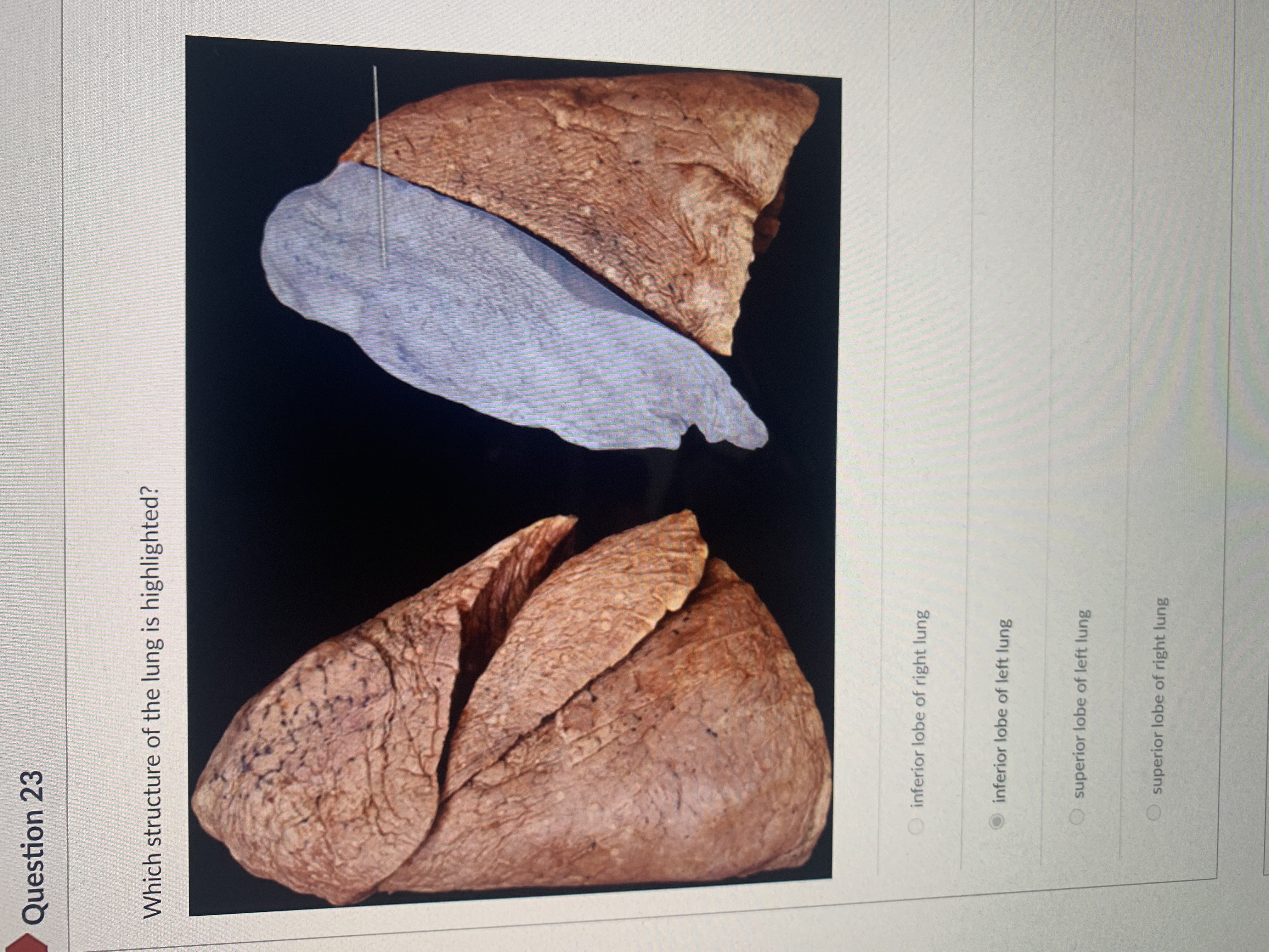 **Question 23**

Which structure of the lung is highlighted?

*Image Description:*
The image shows two sections of lungs, with the right lung on the left and the left lung on the right. The left lung section is highlighted in gray, specifically indicating a certain lobe with an arrow pointing to it.

The lung is divided into lobes, and the highlighted area suggests a significant anatomical division. This highlighted lobe appears to be part of the left lung.

*Options:*

- ○ inferior lobe of right lung
- ● inferior lobe of left lung
- ○ superior lobe of left lung
- ○ superior lobe of right lung

The correct answer appears to be the "inferior lobe of left lung," as indicated by the highlighted section in the image and the selected option.