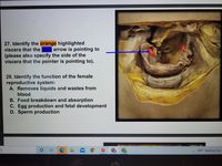 **Educational Resource: Anatomy and Physiology**

**Question 27:**
Identify the orange highlighted viscera that the blue arrow is pointing to. Please also specify the side of the viscera that the pointer is pointing to.

*Image Description:* 
This image includes a detailed anatomical dissection. A blue arrow is pointing towards the highlighted orange viscera. The task is to identify the organ and its specific side.

**Question 28:**
Identify the function of the female reproductive system:
- A: Removes liquids and wastes from blood
- B: Food breakdown and absorption
- C: Egg production and fetal development
- D: Sperm production

*Explanation:* 
This question examines your understanding of the primary roles of the female reproductive system, with a focus on egg production and fetal development.

*Additional Notes:*
The image assists in identifying specific organs or structures within the human body and understanding their physiological roles.