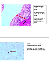 8. Name the tissue
within red double
arrow
9a. Name the tissue
indicated by the black
arrow
9b. Name function of
the tissue which is
with
red
oul
arrow
10. Name the area of the tissue
indicated by the red arrow
11. Name the tissue indicated by
the double black arrow (Full name)
