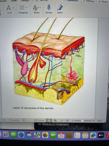 Answered: Label 10 structures of the dermis. | bartleby