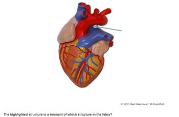 The highlighted structure is a remnant of which structure in the fetus?
LT-G12: Giant Heart 4-part, 3B Scientific