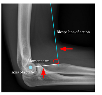 Moment arm
Axis of rotation
Biceps line of action