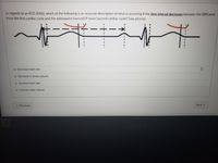 In regards to an ECG (EKG), which of the following is an accurate description of what is occurring if the time interval decreases between the QRS peak
from the first cardiac cycle and the subsequent (second) P wave (second cardiac cycle)? (see picture).
O Decrease heart rate
O Decrease in stroke volume
Increase heart rate
O Increase stoke volume
« Previous
Next
