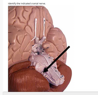 Identify the indicated cranial nerve.
