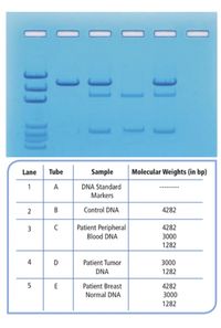 Lane
Tube
Sample
Molecular Weights (in bp)
1
A
DNA Standard
Markers
2
В
Control DNA
4282
Patient Peripheral
4282
Blood DNA
3000
1282
4
D
Patient Tumor
3000
DNA
1282
E
Patient Breast
4282
Normal DNA
3000
1282
]]] )
