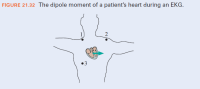 FIGURE 21.32 The dipole moment of a patient's heart during an EKG.
1
2
3
