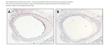 Immunohistochemical staining of an ApoE -/- mouse brachiocephalic artery after blocking and subsequent incubation
with a primary and secondary antibody. Image A shows positive and specific staining for an extracellular matrix
molecule. Image B is the negative control image.
A
B