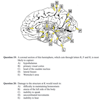 R
M
N
E
A
G
P
K
Question 19: A coronal section of this hemisphere, which cuts through letters R, F and H, is most
likely to capture:
A) hypothalamus
B)
primary visual cortex
C) head of the caudate nucleus
D) lateral fissure
E)
Wernicke's area
Question 20: Damage to the structure at K would result in:
A) difficulty in maintaining homeostasis
ataxia of the left side of the body
B)
C)
inability to speak
uncoordinated movements
D)
E)
inability to hear
SI
