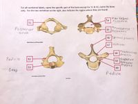 For all numbered labels, name the specific part of the bone except for 51 & 52, name the bone
only. For the two vertebrae on the right, also indicate the region where they are found.
Vertebral
54
Foramen
51
Transverse
Foramen
55
Posterior
arch
56 Spinous process
57 lamina
Mark Nielsen and Shawn Miller
Transverse
58
Process
Superior
Pedicle
52
59
articular
Process
60
53
Dens
Pedicle
Mark Nielsen and Shawn Mller
Mark Nialen
