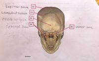 Sagittal suture
21
msn
Lambdoid suture
22
23
Occipital bone
24
Sphenoid bone"
Vomer bone
25
Mark Nielsen
