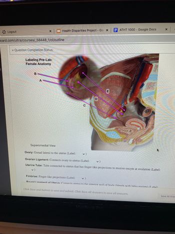 Logout
* Question Completion Status:
oard.com/ultra/courses/_58448_1/cl/outline
Labeling Pre-Lab:
Female Anatomy
A
10
Superomedial View
Health Disparities Project - Gox EATHT 1000 - Google Docs
E
GE
Ovary: Gonad lateral to the uterus (Label:
Ovarian Ligament: Connects ovary to uterus (Label:
Uterine Tube: Tube connected to uterus that has finger-like projections to receive oocyte at ovulation (Label:
Fimbriae: Finger-like projections (Label: v)
Round Linament of Uterus: Connects uterus to the anterior wall of body (blends with lahia maiora) (I abel:
MacBook Pro
Click Save and Submit to save and submit. Click Save All Answers to save all answers.
X
Save All Answ