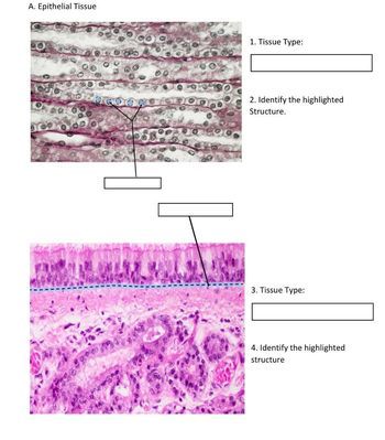 Answered: A. Epithelial Tissue 1. Tissue Type: 2.… | Bartleby