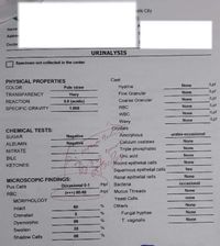 oilo City
Name
Addre
Doctor
URINALYSIS
Specimen not collected in the center
Cast
PHYSICAL PROPERTIES
None
Lpf
COLOR
Pale straw
Hyaline
Fine Granular
None
Lpf
TRANSPARENCY
Hazy
REACTION
5.0 (acidic)
Coarse Granular
None
/Lpf
None
Lpf
SPECIFIC GRAVITY
1.005
RBC
WBC
None
Lpf
None
Lpf
Waxy
Crystals
Amorphous
CHEMICAL TESTS:
urates-occasional
Negative
Negativo
SUGAR
None
Calcium oxalates
Triple phosphates
Uric acid
Round epithelial cells
ALBUMIN
None
NITRATE
None
BILE
None
KETONES
Squamous epithelial cells
Renal epithelial cells
few
None
MICROSCOPIC FINDINGS:
Occasional
Pus Cells
Occasional 0-1
/Hpf
Bacteria
(+) 80-90
/Hpf Mucus Threads
None
RBC
Yeast Cells
none
MORPHOLOGY
Others
None
Intact
60
Fungal hyphae
None
Crenated
T vaginalis
None
00
%
Dysmorphic
Swollen
35
Shadow Cells
00
3333
