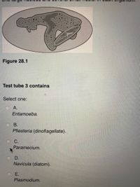 Figure 28.1
Test tube 3 contains
Select one:
А.
Entamoeba.
В.
Pfiesteria (dinoflagellate).
С.
Paramecium.
D.
Navicula (diatom).
Е.
Plasmodium.
