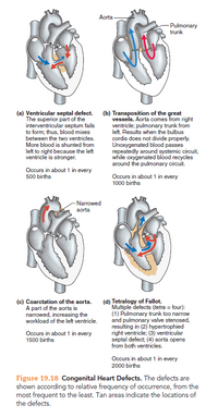 Answered: Aorta -Pulmonary trunk (a) Ventricular… | bartleby