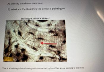 A) Identify the tissue seen here.
B) What are the thin lines the arrow is pointing to.
Histology Lab Part 9: Slide 42
LUMEN
This is a histology slide showing cells connected by lines. Red arrow pointing to the lines.