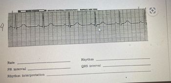 9
Rate
PR interval
TUDITH
J GRAPHIC CONTROLS CORPORATION BUFFALO, NEW YORK
Rhythm interpretation
Rhythm
QRS interval
رو