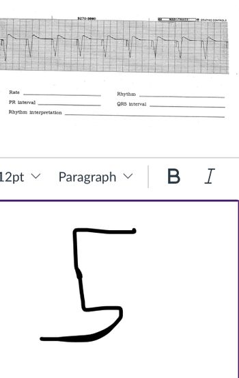 Rate
PR interval
Rhythm interpretation
12pt ✓
V
9270-0980
Paragraph
Rhythm
QRS interval
V
L
MEOPTRACE GRAPHIC CONTROLS
B I