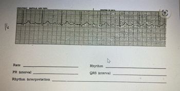 16
IPORATION BUFFALO. NEW YORK
Rate
PR interval
Rhythm interpretation
INTED IN USA
Rhythm
QRS interval