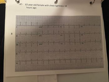 65
III
V1
#7- 63 year-old female with chest tightness 18
hours ago
++++
M
MITT
AVI
SK-E------