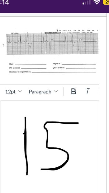 :14
n
9270-0980
Rate
PR interval
Rhythm interpretation
12pt ✓
Paragraph
27 SEP
GY MASONRY GRAPHIC CONTROLS CORPORATION BUFFALO NEW YORK
09:36:38
Rhythm
QRS interval
HIR 166 1
| B I
15
(
25