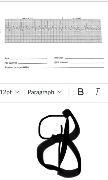 Rate
PR interval
PRINTED IN USA
Rhythm interpretation
12pt ✓
Paragraph
Rhythm
QRS interval
9270-0980
B I
9