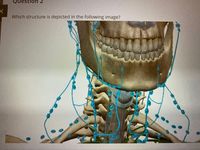 destion 2
Which structure is depicted in the following image?
