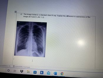 xt Predictions: On
O
+
c) The image below is a standard chest X-ray. Explain the difference in appearance of the
image at A and B. (AC 1.2)
Sin
Accessibility: Investigate
At
ww
B
B.