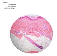 Answered: Dermis Papillary layer Reticular layer… | bartleby