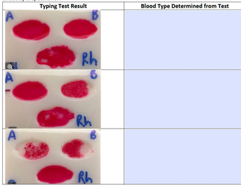 Typing Test Result
Blood Type Determined from Test
Rh
A
Rh
Rh