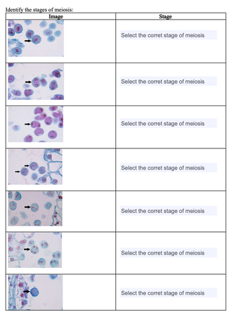 Identify the stages of meiosis:
Image
Stage
Select the corret stage of meiosis
Select the corret stage of meiosis
Select the corret stage of meiosis
Select the corret stage of meiosis
Select the corret stage of meiosis
Select the corret stage of meiosis
Select the corret stage of meiosis