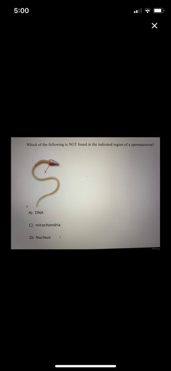 5:00
Which of the following is NOT found in the indicated region of a spermatozoon?
S
A) DNA
C) mitochondrial
D) Nucleus
X
I