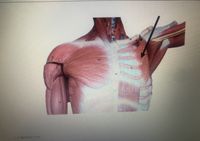 The image shows a detailed anatomical illustration of the upper torso, highlighting the musculature around the shoulder region. The focus is on the pectoralis minor muscle, as indicated by the black arrow. The pectoralis minor is located beneath the larger pectoralis major muscle and is one of the key muscles involved in the movement of the scapula.

The muscles are shown in a realistic reddish hue, with fibers and contours illustrating their structure and direction. The diagram indicates surrounding areas, including part of the rib cage to which the pectoralis minor attaches. Proper understanding of this muscle's position and function is essential for fields such as medicine, physiotherapy, and sports science.

* A. Pectoralis minor

This depiction serves as an educational aid in understanding the anatomical relationships and functions of the muscles in the shoulder and chest region.