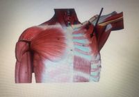 The image depicts the muscles of the upper torso, particularly focusing on the pectoral region. The major muscle groups visible include:

1. **Pectoralis Major**: This large muscle covers the upper chest and contributes to the movement of the shoulder joint. It is shown prominently across the chest area.

2. **Serratus Anterior**: Located on the lateral aspect of the thorax, these muscles appear serrated and are involved in the upward rotation and protraction of the scapula.

3. **Intercostal Muscles**: These muscles are located between the ribs and are involved in the mechanical aspect of breathing by aiding in the expansion and contraction of the chest cavity.

The image also includes an arrow pointing to a specific muscle group, possibly indicating the highlighted region for educational focus. This could refer to an illustrative emphasis on the **Pectoralis Minor**, a smaller muscle situated underneath the Pectoralis Major and involved in stabilization, depression, abduction, or protraction of the scapula.

This anatomical illustration is valuable for understanding the muscular structure and arrangement in the pectoral region, aiding in the study of kinesiology and anatomy.