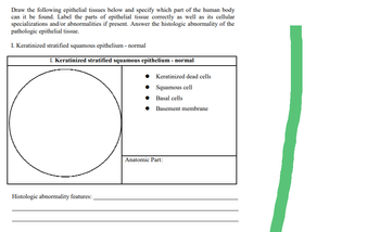 Draw the following epithelial tissues below and specify which part of the human body
can it be found. Label the parts of epithelial tissue correctly as well as its cellular
specializations and/or abnormalities if present. Answer the histologic abnormality of the
pathologic epithelial tissue.
I. Keratinized stratified squamous epithelium - normal
I. Keratinized stratified squamous epithelium - normal
Histologic abnormality features:
Keratinized dead cells
Squamous cell
Basal cells
● Basement membrane
●
●
●
Anatomic Part: