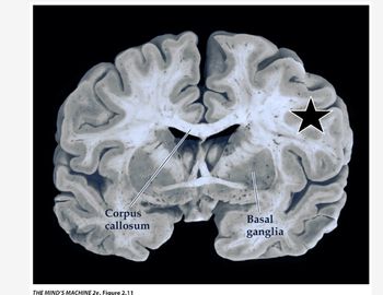 Corpus
callosum
THE MIND'S MACHINE 2e. Figure 2.11
Basal
ganglia