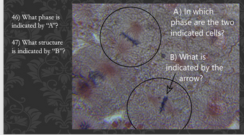 Answered: 46) What Phase Is Indicated By "A""?… | Bartleby