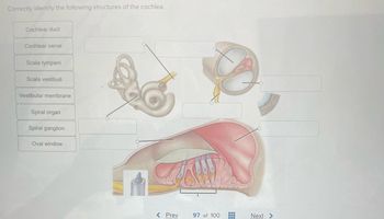 **Correctly Identify the Following Structures of the Cochlea**

The provided image is a detailed illustration of the cochlea, a key component of the inner ear responsible for hearing. The cochlea is shown from different views to provide a comprehensive understanding of its anatomy. Below are the structures that need to be identified:

1. **Cochlear Duct**: This is a fluid-filled cavity within the cochlea located between the scala tympani and scala vestibuli, also known as the scala media.
2. **Cochlear Nerve**: This nerve carries auditory information from the cochlea to the brain.
3. **Scala Tympani**: This is one of the three fluid-filled passages in the cochlea, located below the cochlear duct.
4. **Scala Vestibuli**: Another fluid-filled passage in the cochlea, positioned above the cochlear duct.
5. **Vestibular Membrane**: Also called Reissner's membrane, this structure separates the cochlear duct from the scala vestibuli.
6. **Spiral Organ**: Also known as the organ of Corti, it contains hair cells that convert sound vibrations into electrical signals.
7. **Spiral Ganglion**: These neurons transmit auditory information from the hair cells of the cochlea to the brain.
8. **Oval Window**: A membrane-covered opening that leads from the middle ear to the vestibule of the inner ear.

Each structure is critical for the process of hearing and contributes to the conversion of sound waves into neural signals that can be interpreted by the brain. Understanding these components is essential for comprehending how the auditory system functions.

In the image, these structures are marked with lines pointing to different parts of the cochlea. To correctly identify each part, follow the lines from the boxes labeled on the left to the respective anatomical parts on the right. The image includes cross-sectional and side views of the cochlea to depict these structures accurately.