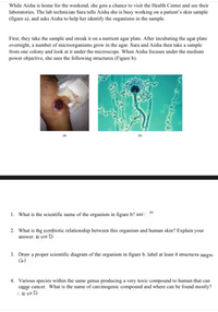 While Aisha is home for the weekend, she gets a chance to visit the Health Center and see their
laboratories. The lab technician Sara tells Aisha she is busy working on a patient's skin sample
(figure a), and asks Aisha to help her identify the organisms in the sample.
First, they take the sample and streak it on a nutrient agar plate. After incubating the agar plate
ovemight, a number of microorganisms grow in the agar. Sara and Aisha then take a sample
from one colony and look at it under the microscope. When Aisha focuses under the medium
power objective, she sees the following structures (Figure b).
1. What is the scientific name of the organism in figure b? ani
2. What is the svmbiotic relationship between this organism and human skin? Explain your
answer. (e cn S)
3. Draw a proper scientific diagram of the organism in figure b. label at least 4 structures (sgro
(3)
4. Various species within the same genus producing a very toxic compound to human that can
cange cancer. What is the name of careinogenic compound and where can be found mostly?
r. fe ort S)
