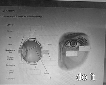 Eye Anatomy
Comea
Label the images to review the anatomy of the eye.
Iris
Lens
Nasolacrimal
duct
Vitreous
chamber
Conjunctiva
Lacrimal
gland
learn
Optic nerve
mika
plus
Lens
Retina
VAN
महाकाल
WWW
do it