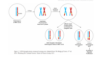 NATIONAL CENTER
CASE
TUDI TEAChING IN SCIENCE
X
X X
Mitotic
S Phase
Reciprocal
Crossover
Mut RB1
Heterozygous
at RB1 Locus
Duplicated
Chromosomes
result from S phase
Mitosis Could
Produce Either
Combination of
Daughter Cells
DO
DO
Both Daughter Cells Retain
Heterozygous Status at RB1 Locus
LOH to
LOH to
Homozygous
Homozygous
WT
MUT
Figure 1. LOH through mitotic reciprocal crossing over. Adapted from The Biology of Cancer, 2nd ed.
2014. Weinberg RA. Garland Science, Taylor & Francis Group, LLC.
No Ability to
Regulate
Proliferation
