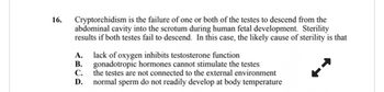 16.
Cryptorchidism is the failure of one or both of the testes to descend from the
abdominal cavity into the scrotum during human fetal development. Sterility
results if both testes fail to descend. In this case, the likely cause of sterility is that
A. lack of oxygen inhibits testosterone function
B. gonadotropic hormones cannot stimulate the testes
C.
the testes are not connected to the external environment
normal sperm do not readily develop at body temperature
D.