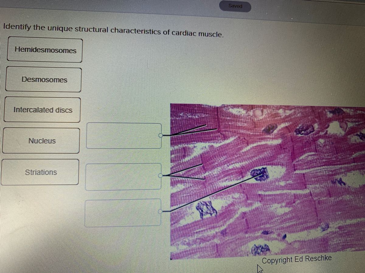 desmosomes in cardiac muscle