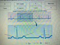 g each label into the appropriate position
QRS complex
Alpha wave
P wave
ST segment
Twave
Copyright McGraw-Hill Education. Permission required for reproduction or display
5 of 20
Next
>
S.
