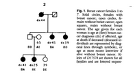 2
Flg. 1. Breast cancer families 1 to
7. Solid circles, females with
breast cancer; open circles, fe-
males without breast cancer; open
squares, males without breast
cancer. The age given for each
woman is age at (first) breast can-
cer diagnosis (dx) if affected, age
at death if deceased (deceased in-
dividuals are represented by diag-
onal lines through symbols), or
age at most recent interview if
alive without breast cancer. Al-
leles of D17S74 are shown for all
families and are lettered sequen-
dx 44
dx 45 dx 39
BA 80
65
BD AE
dx 41 dx 23
39
BA BE
DE
