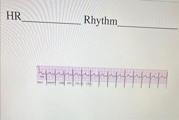 Answered: HR VS Sem's O 150 005 Rhythm fifififif… | bartleby